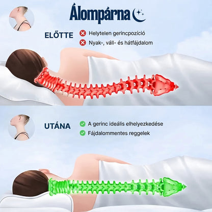 Álompárna - Ébredjen fájdalom nélkül